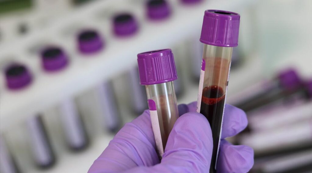 Gloved hand holding two test tubes containing blood